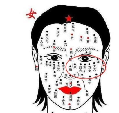 What are the 0 malignant moles on the face that must be removed? Does Lantai Tingwei have moles that bring wealth or destroy it? Picture 5