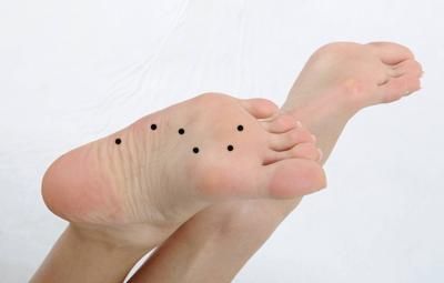 The fate of children with moles on the soles of their feet. What does moles on the soles of their feet mean? Picture 4