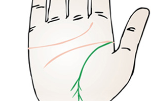 Lifeline bifurcation diagram, lifeline end bifurcation diagram Figure 2